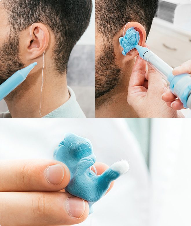 Creating custom hearing solutions with a mold of the inside of ear at True North Hearing